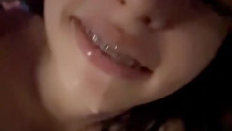 2024_10_06_this_braceface_is_begging_for_it_,,_2_repost_2024_12